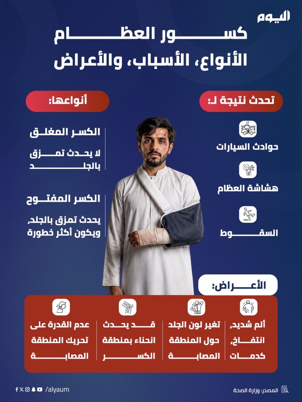 كسور العظام.. الأنواع والأسباب والأعراض